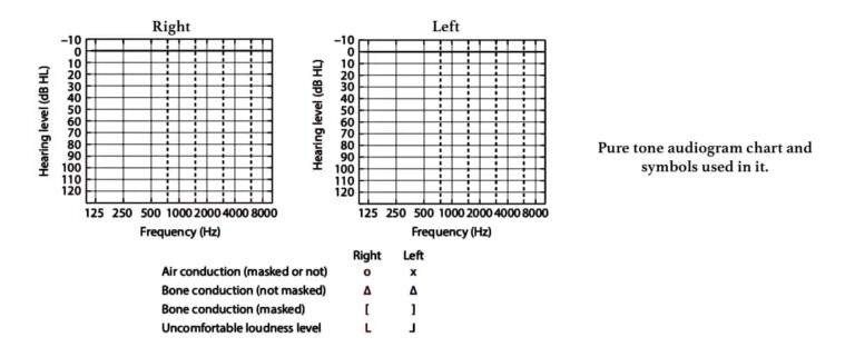 Audiometry Objective Tests For Hearing Assessment Audiometry Objective Tests For Hearing Assessment