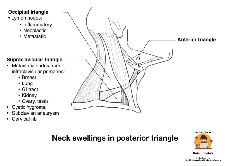 Neck Swellings. Dr. Rahul Bagla ENT Textbook