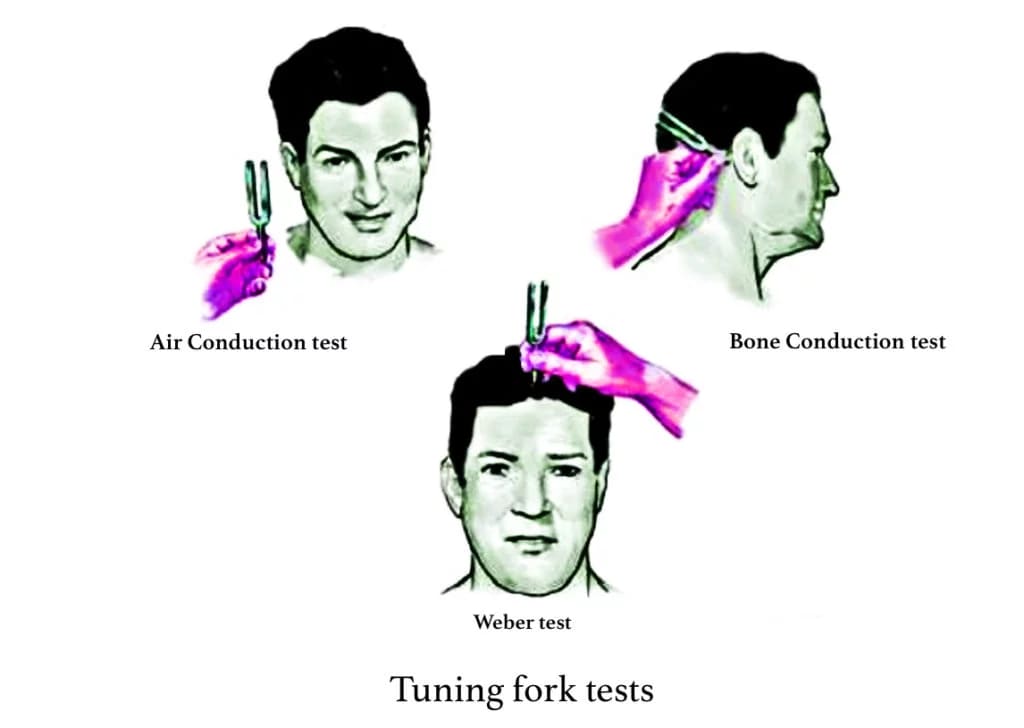 Assessment of hearing - Hearing tests