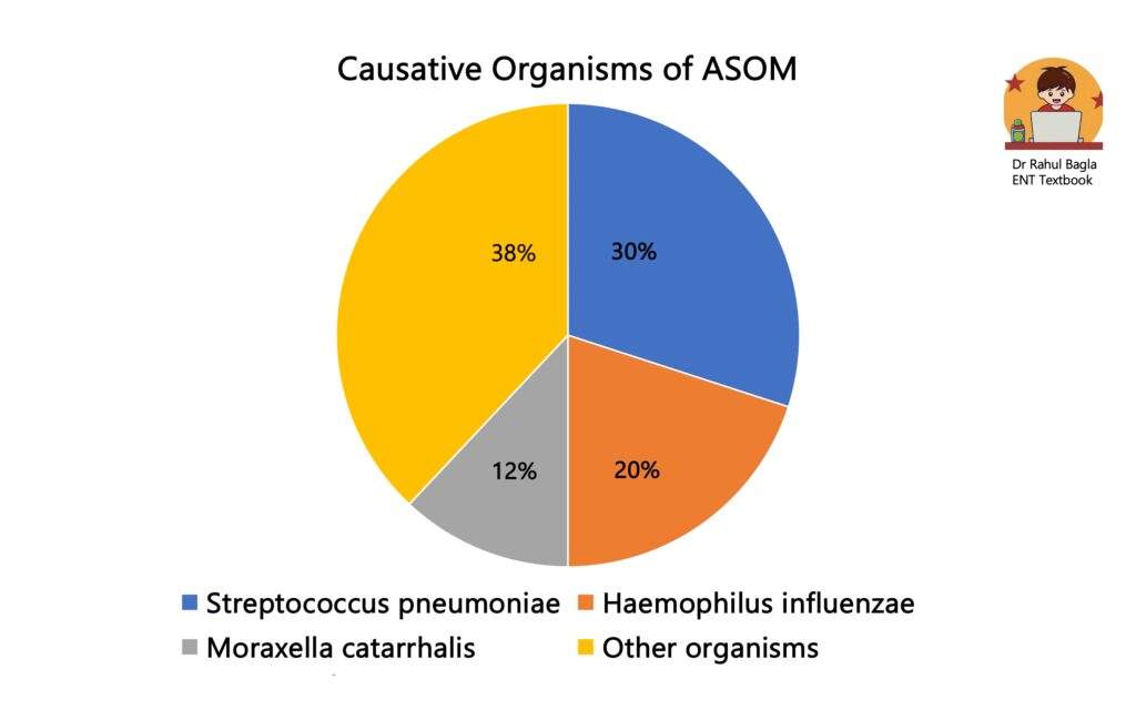 ASOM - Acute Suppurative Otitis Media - Lighthouse effect