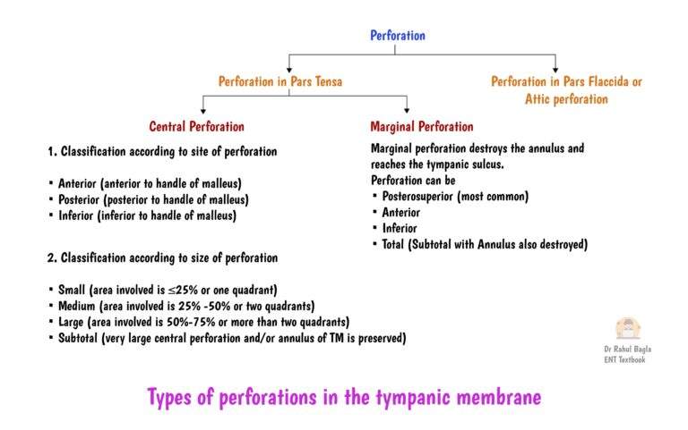 Chronic Suppurative Otitis Media - PPT, Treatment Guidelines