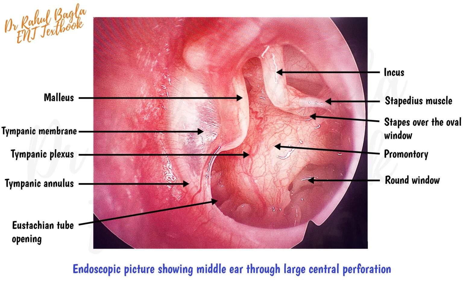 Anatomy Of Middle Ear Dr Rahul Bagla ENT Textbook