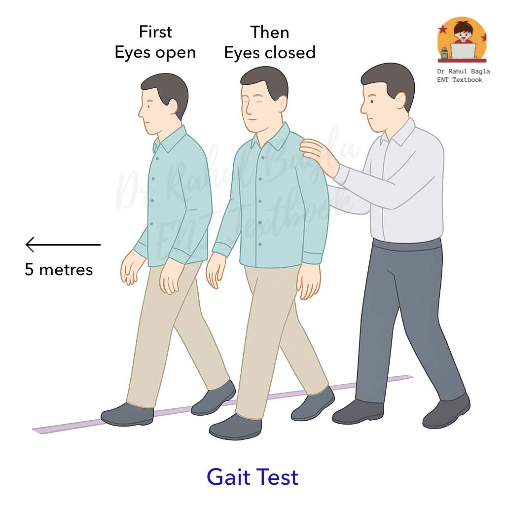 Gait Test Dr Rahul Bagla ENT Textbook