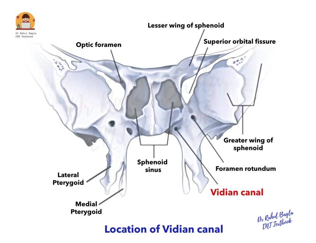 Location of Vidian canal Juvenile nasal angiofibroma Dr Rahul bagla ENT Textbook