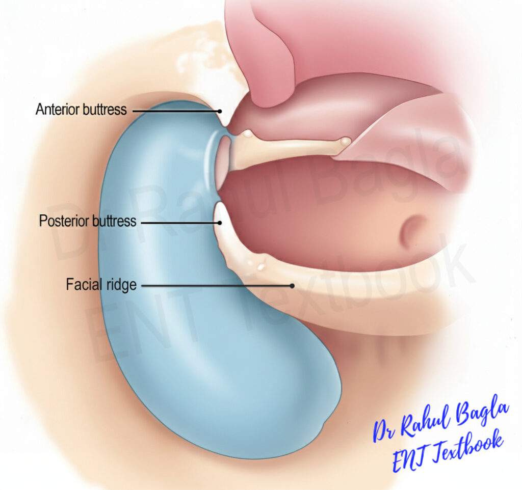 Anterior buttress and Posterior buttress Dr Rahul Bagla ENT Textbook
