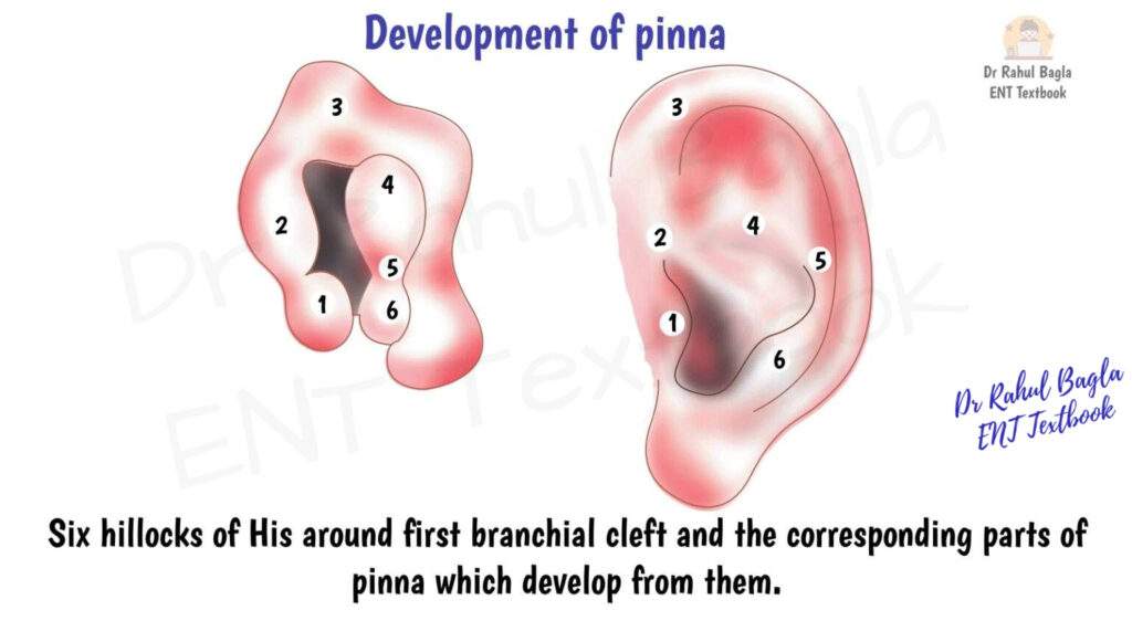 Development-of-pinna-Dr-Rahul-Bagla-1536x843