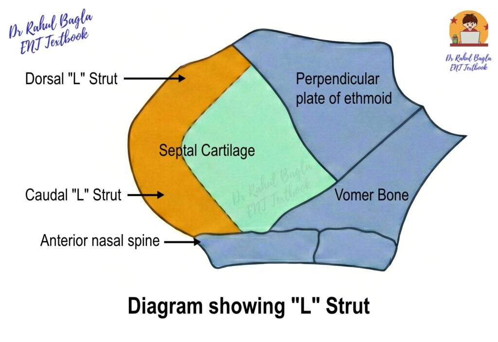 Diagram showing L Strut Septoplasty DNS Dr Rahul Bagla ENT Textbook
