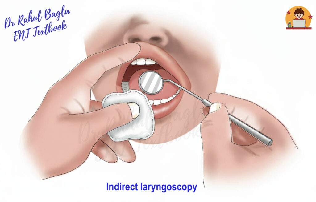 Indirect laryngoscopy Dr Rahul Bagla ENT Textbook
