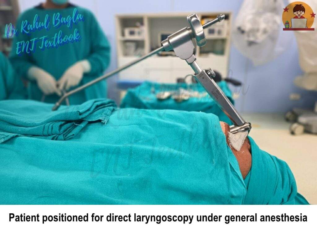 Sniffing, Barking-Dog, Sword Swallowing Position. Patient positioned for direct laryngoscopy under general anesthesia Dr Rahul Bagla