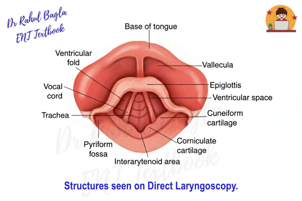 Structures seen on Direct Laryngoscopy Dr Rahul Bagla ENT Textbook