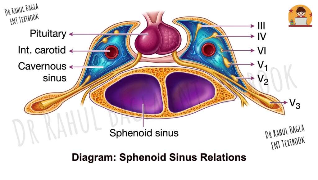 Diagram_ Sphenoid Sinus Relations Dr Rahul Bagla ENT Textbook