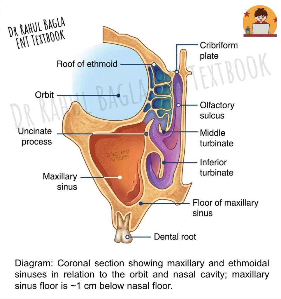 Maxillary and ethmoidal sinuses Dr Rahul Bagla ENT Textbook