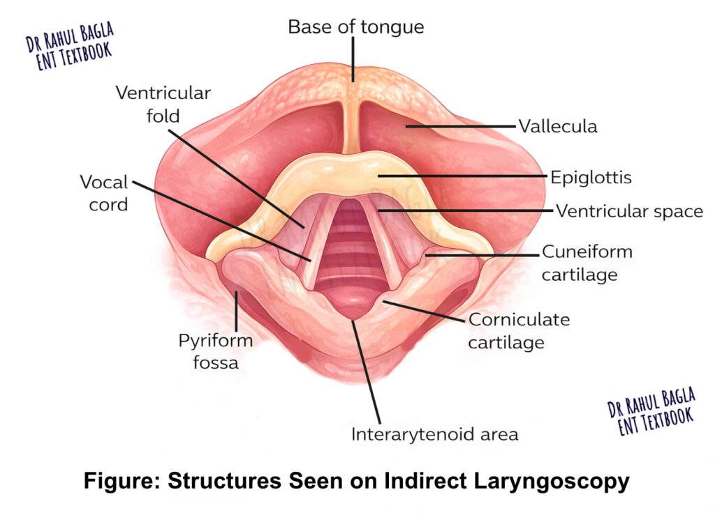 Structures Seen on Indirect Laryngoscopy Dr Rahul Bagla ENT Textbook
