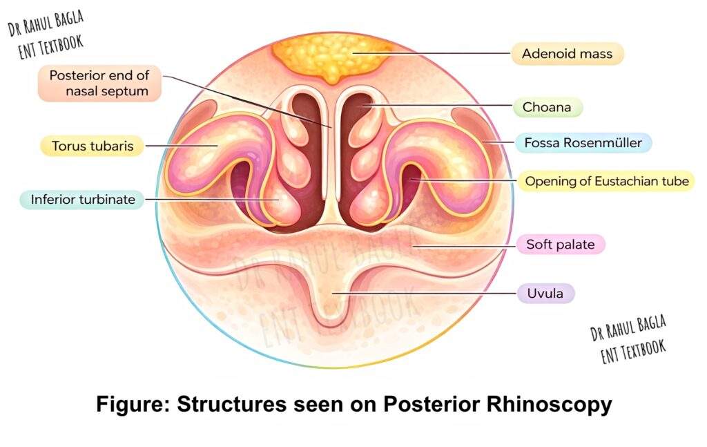Structures seen on Posterior Rhinoscopy Dr Rahul Bagla ENT Textbook