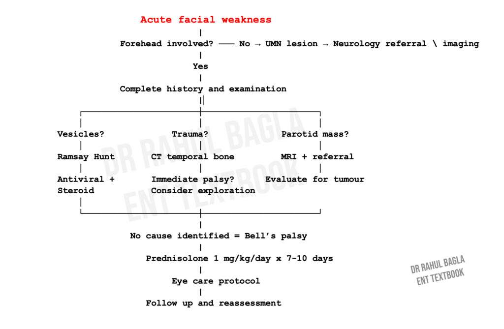 Facial Nerve bell's Palsy treatment Flowchart