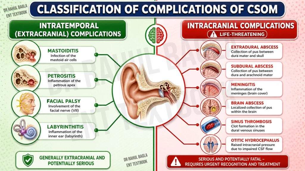 Classification of Complications of SCOM Dr Rahul Bagla ENT Textbook