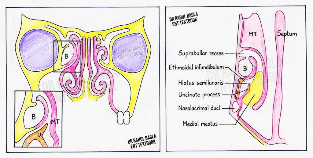Schematic representation of the osteomeatal complex in coronal sections